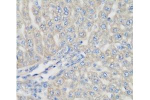 Immunohistochemistry of paraffin-embedded Rat liver using METTL7A Polyclonal Antibody at dilution of 1:200 (40x lens). (METTL7A antibody)