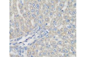 Immunohistochemistry of paraffin-embedded Rat liver using METTL7A Polyclonal Antibody at dilution of 1:200 (40x lens).