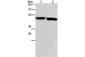 Western Blot analysis of Mouse stomach and brain tissue using CLUAP1 Polyclonal Antibody at dilution of 1:500 (CLUAP1 antibody)