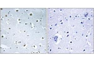 Immunohistochemistry analysis of paraffin-embedded human brain tissue, using TUBGCP3 Antibody. (TUBGCP3 antibody  (AA 201-250))