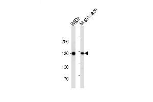 Lane 1: WiDr, Lane 2: mouse stomach lysate at 20 µg per lane, probed with bsm-51214M CDH1 (813CT11. (E-cadherin antibody)