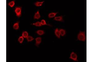 ABIN6266686 staining LOVO by IF/ICC. (TRIM38 antibody  (Internal Region))