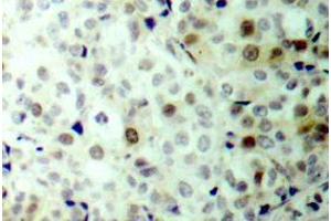 Image no. 2 for anti-Cyclin-Dependent Kinase 1 (CDK1) (pThr161) antibody (ABIN317981) (CDK1 antibody  (pThr161))