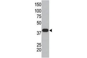 SUMO polyclonal antibody used in western blot to detect GST-SUMO1 fusion protein. (SUMO1 antibody  (AA 55-86))