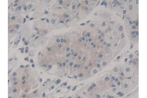 DAB staining on IHC-P; Samples: Human Stomach Tissue (Nestin antibody  (AA 178-399))