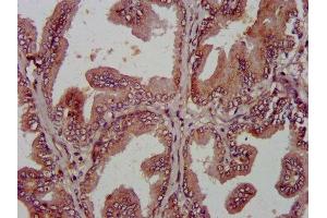 IHC image of ABIN7144036 diluted at 1:800 and staining in paraffin-embedded human prostate tissue performed on a Leica BondTM system. (AMIGO2 antibody  (AA 420-522))