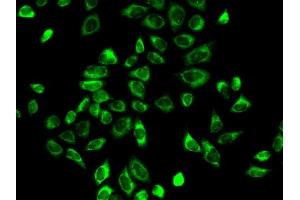 Immunofluorescence analysis of A-549 cells using HSD3B2 antibody (ABIN6131145, ABIN6142018, ABIN6142019 and ABIN6218943). (HSD3B2 antibody  (AA 1-287))