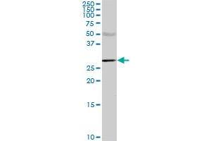 CA1 monoclonal antibody (M02), clone M2. (CA1 antibody  (AA 1-261))