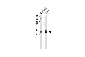 All lanes : Anti-CXCL2 Antibody (C-term) at 1:1000-1:2000 dilution Lane 1: Human breast whole tissue lysate Lane 2: Human liver whole tissue lysate Lysates/proteins at 20 μg per lane. (CXCL2 antibody  (C-Term))