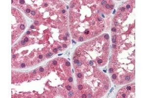 IDH1 antibody was used for immunohistochemistry at a concentration of 4-8 ug/ml. (IDH1 antibody)