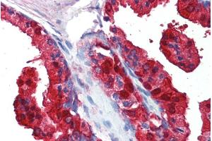 ABIN185332 (5µg/ml) staining of paraffin embedded Human Prostate. (SORD antibody  (C-Term))