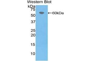 Detection of Recombinant F7, Bovine using Polyclonal Antibody to Coagulation Factor VII (F7) (Factor VII antibody  (AA 193-447))