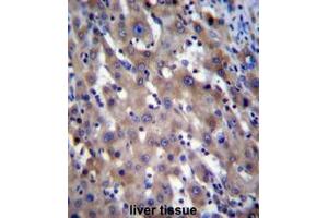 RPGR Antibody (C-term) immunohistochemistry analysis in formalin fixed and paraffin embedded human liver tissue followed by peroxidase conjugation of the secondary antibody and DAB staining. (RPGR antibody  (C-Term))