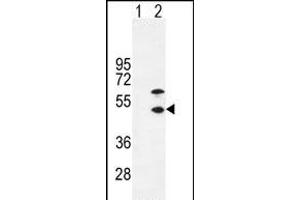 Western blot analysis of CKM (arrow) using rabbit polyclonal CKM-T6 (ABIN391095 and ABIN2841234). (CKM antibody  (N-Term))