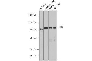 Western blot analysis of extracts of various cell lines using BTK Polyclonal Antibody at dilution of 1:1000. (BTK antibody)