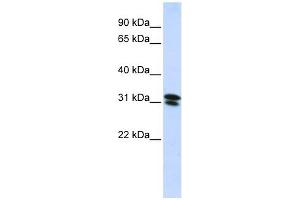 RNF182 antibody used at 1 ug/ml to detect target protein. (RNF182 antibody  (N-Term))