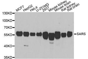 Western blot analysis of extracts of various cell lines, using SARS antibody. (Seryl-tRNA Synthetase (SARS) (AA 1-300) antibody)