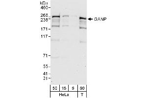 anti-Minichromosome Maintenance Complex Component 3 Associated Protein (MCM3AP) (AA 1930-1980) antibody