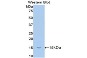 Western Blotting (WB) image for anti-Trefoil Factor 2 (TFF2) (AA 25-127) antibody (ABIN1173510)