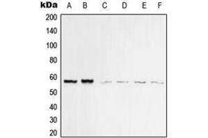 Western blot analysis of Vimentin expression in MCF7 (A), MDAMB435 (B), KNRK (C), HeLa (D), Raw264.