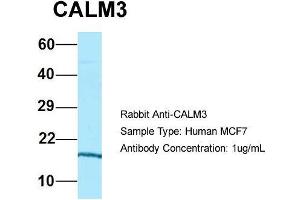 Host: Rabbit  Target Name: CALM3  Sample Tissue: Human MCF7  Antibody Dilution: 1. (Calmodulin 3 antibody  (N-Term))