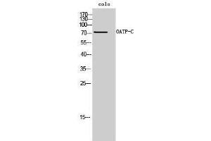 Western Blotting (WB) image for anti-Solute Carrier Organic Anion Transporter Family, Member 1B1 (SLCO1B1) (Internal Region) antibody (ABIN3185986) (SLCO1B1 antibody  (Internal Region))