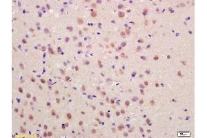 Formalin-fixed and paraffin embedded rat brain labeled with Rabbit Anti SOCS3 Polyclonal Antibody, Unconjugated (ABIN670416) at 1:200 followed by conjugation to the secondary antibody and DAB staining (SOCS3 antibody  (AA 155-225))