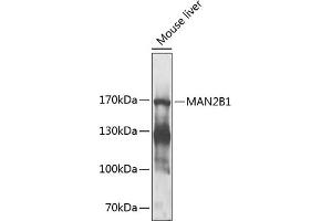 Western blot analysis of extracts of mouse liver, using MB1 antibody (ABIN6131403, ABIN6143456, ABIN6143457 and ABIN6225266) at 1:1000 dilution. (MAN2B1 antibody  (AA 640-850))