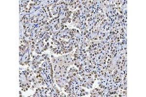 IHC analysis of CAD using anti-CAD antibody (ABIN7600044).