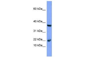 WB Suggested Anti-MB Antibody Titration:  0. (MB antibody  (N-Term))