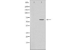 Western blot analysis of extracts from HeLa cells using GRK7 antibody. (GRK7 antibody  (Internal Region))