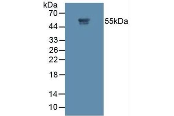 MMP11 antibody  (AA 277-488)