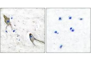 Immunohistochemistry analysis of paraffin-embedded human brain tissue, using PYK2 (Ab-881) Antibody. (PTK2B antibody  (AA 847-896))