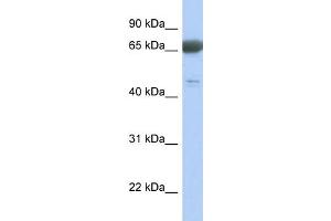 WB Suggested Anti-PNMA3 Antibody Titration: 0.