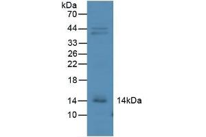 Detection of IP10 in Mouse Kidney Tissue using Polyclonal Antibody to Interferon Gamma Induced Protein 10 kDa (IP10) (CXCL10 antibody  (AA 22-98))
