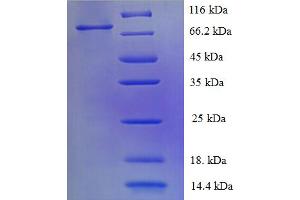 SDS-PAGE (SDS) image for Receptor tyrosine-protein kinase erbB-2 (ErbB2/Her2) (AA 23-652), (Extracellular) protein (His tag) (ABIN5709483)