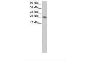 Image no. 1 for anti-Transcription Elongation Factor A2 (TCEA2) (AA 45-94) antibody (ABIN202191) (TCEA2 antibody  (AA 45-94))