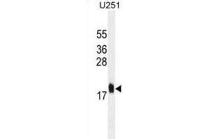 Western Blotting (WB) image for anti-Multiple Coagulation Factor Deficiency 2 (MCFD2) antibody (ABIN2995326) (MCFD2 antibody)