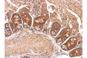 IHC-P Image eEF2 antibody detects eEF2 protein at cytosol on mouse intestine by immunohistochemical analysis. (EEF2 antibody)