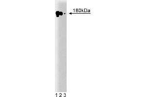 Western Blotting (WB) image for anti-Epidermal Growth Factor Receptor (EGFR) (AA 1020-1046) antibody (ABIN967697) (EGFR antibody  (AA 1020-1046))