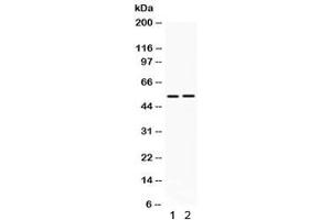 Western blot testing of human 1) HeLa and 2) MCF7 lysate with HSF4 antibody.