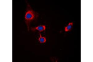 Immunofluorescent analysis of GABRB1 (pS434) staining in MCF7 cells.