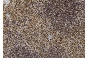 ABIN6276887 at 1/100 staining Mouse spleen tissue by IHC-P. (XRCC2 antibody  (C-Term))