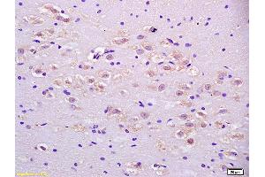 Formalin-fixed and paraffin embedded rat brain labeled with Anti-IDH3A Polyclonal Antibody, Unconjugated (ABIN751543) at 1:200 followed by conjugation to the secondary antibody and DAB staining. (IDH3A antibody  (AA 281-366))