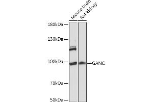 Western blot analysis of extracts of various cell lines, using GANC Rabbit pAb (ABIN7267406) at 1:1000 dilution. (GANC antibody  (AA 100-200))