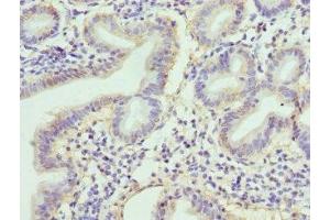 Immunohistochemistry of paraffin-embedded human duodenal tissue using ABIN7167845 at dilution of 1:100 (RBP2 antibody  (AA 1-134))