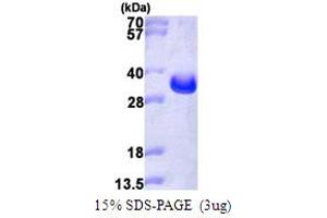 SDS-PAGE (SDS) image for Linker For Activation of T Cells (LAT) (AA 28-233) protein (His tag) (ABIN7279583) (LAT Protein (AA 28-233) (His tag))
