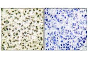 Immunohistochemistry (IHC) image for anti-X-Ray Repair Complementing Defective Repair in Chinese Hamster Cells 5 (Double-Strand-Break Rejoining) (XRCC5) (C-Term) antibody (ABIN1848650) (XRCC5 antibody  (C-Term))