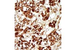 Image no. 2 for anti-Mitogen-Activated Protein Kinase Kinase Kinase MLT (ZAK) (Middle Region) antibody (ABIN360531) (ZAK antibody  (Middle Region))