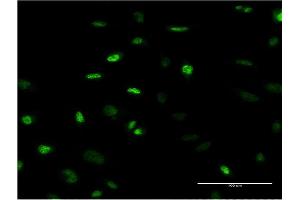 Immunofluorescence of monoclonal antibody to MEFV on HeLa cell. (MEFV antibody  (AA 1-110))